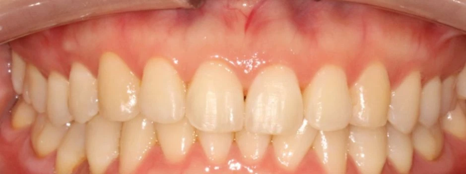before_image