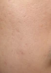 before_image