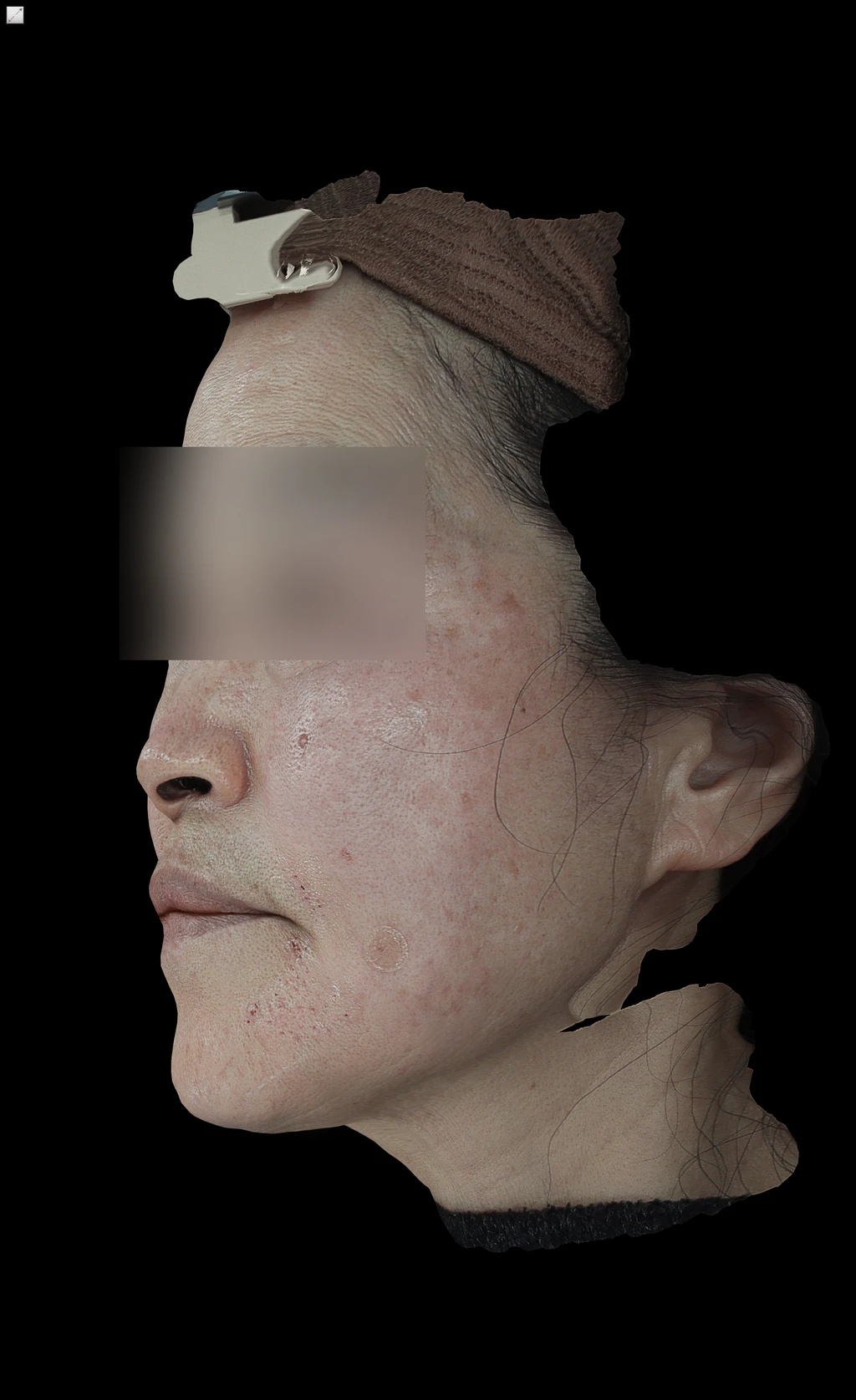 before_image