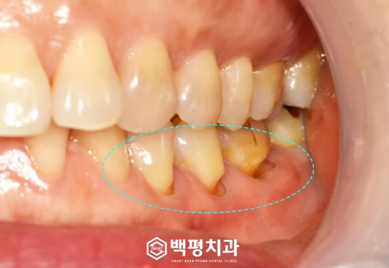 before_image