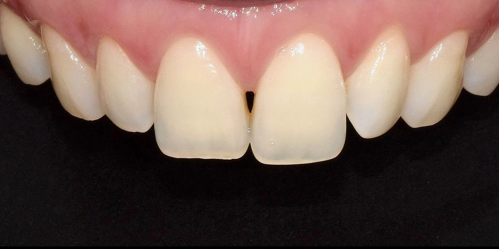 before_image