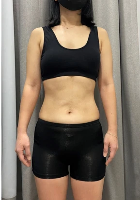before_image