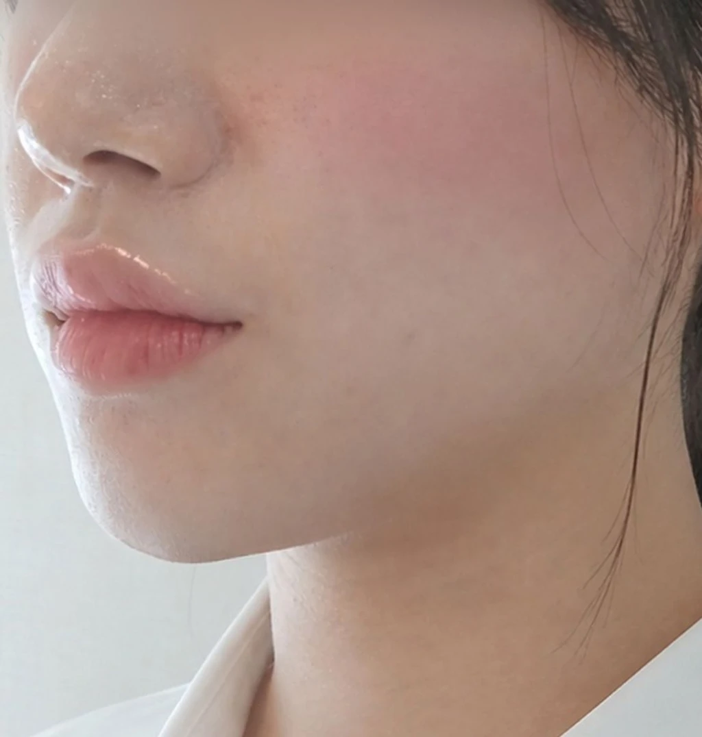 before_image