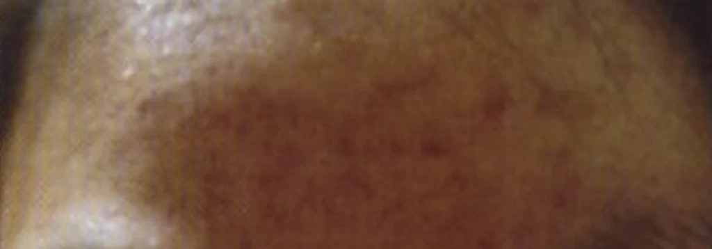 before_image
