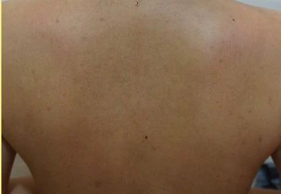 before_image