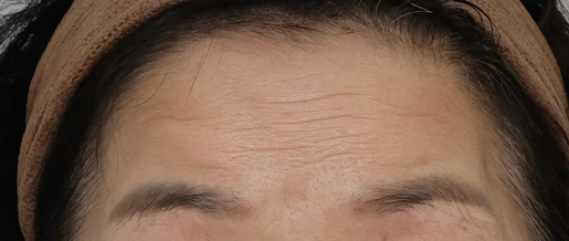 before_image