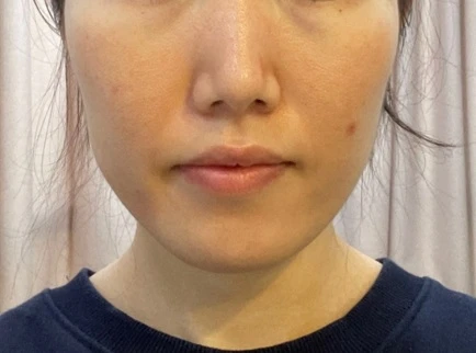 before_image