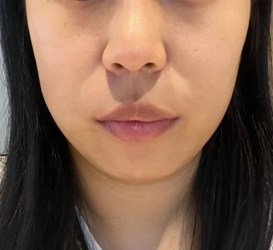 before_image