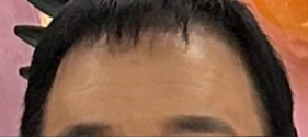 before_image