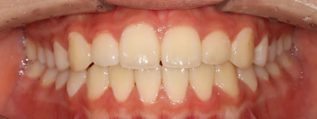 before_image