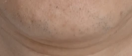 before_image