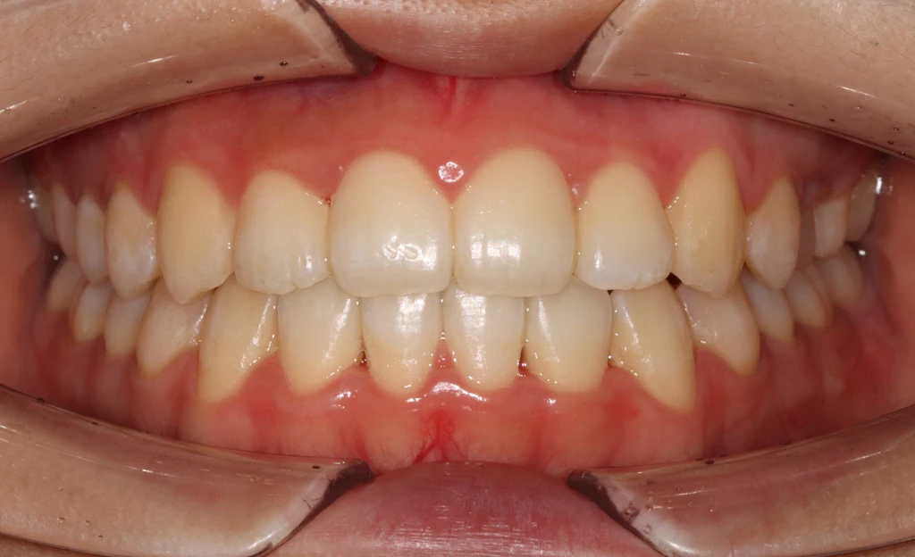 before_image