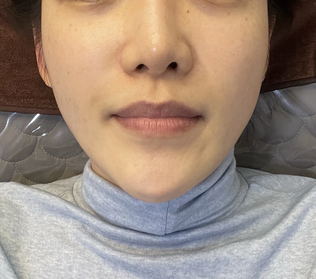before_image