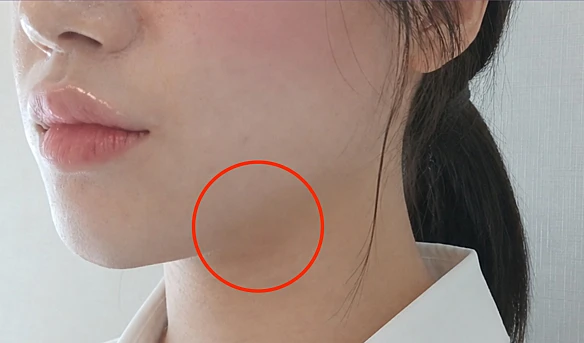 before_image