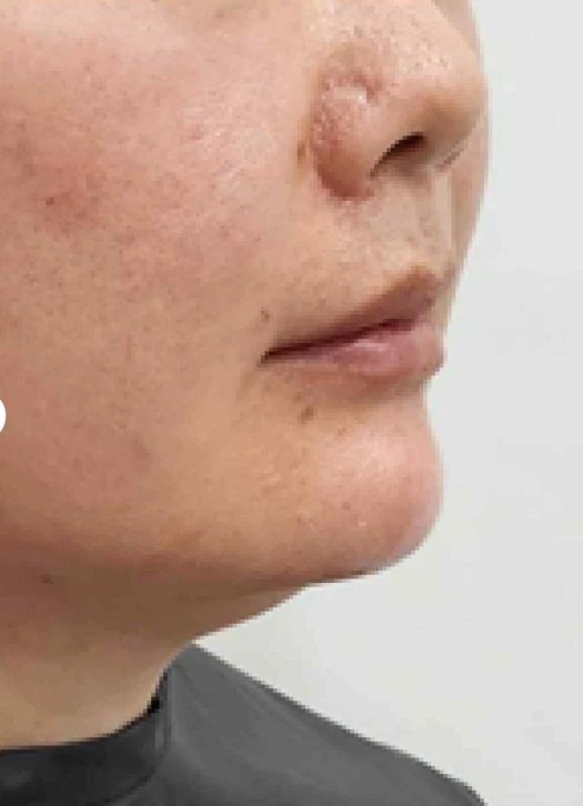 before_image