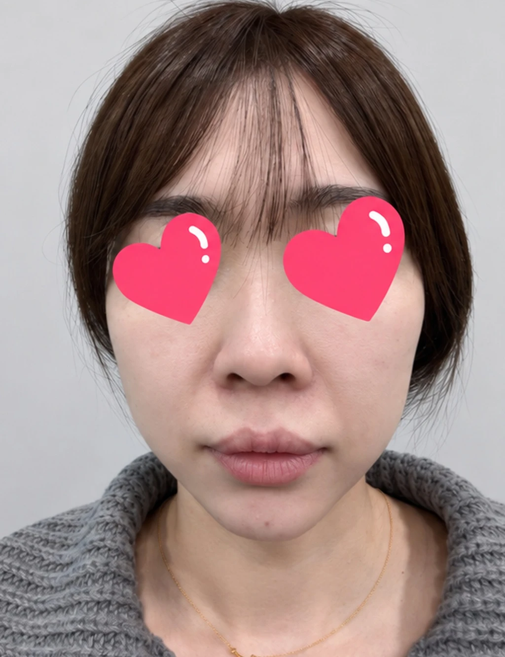 before_image