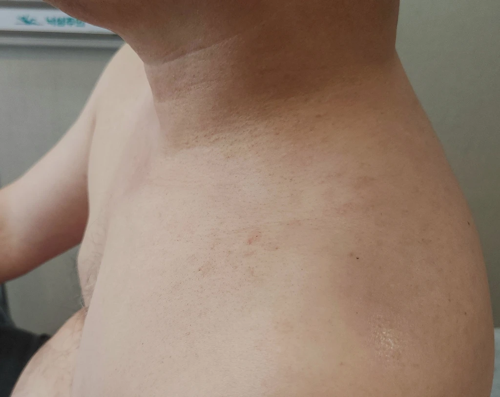 before_image