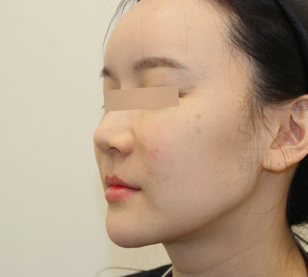 before_image