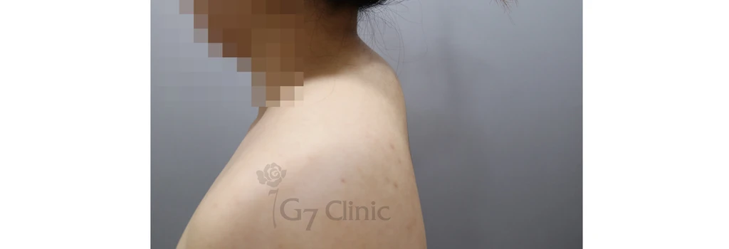 before_image