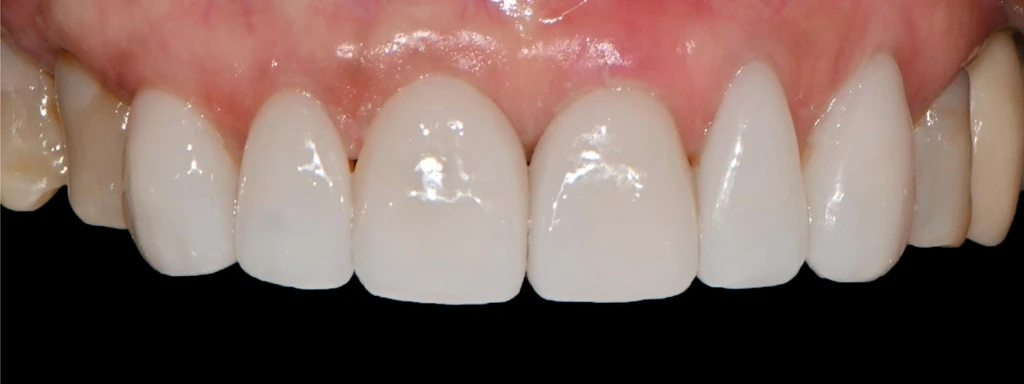 before_image