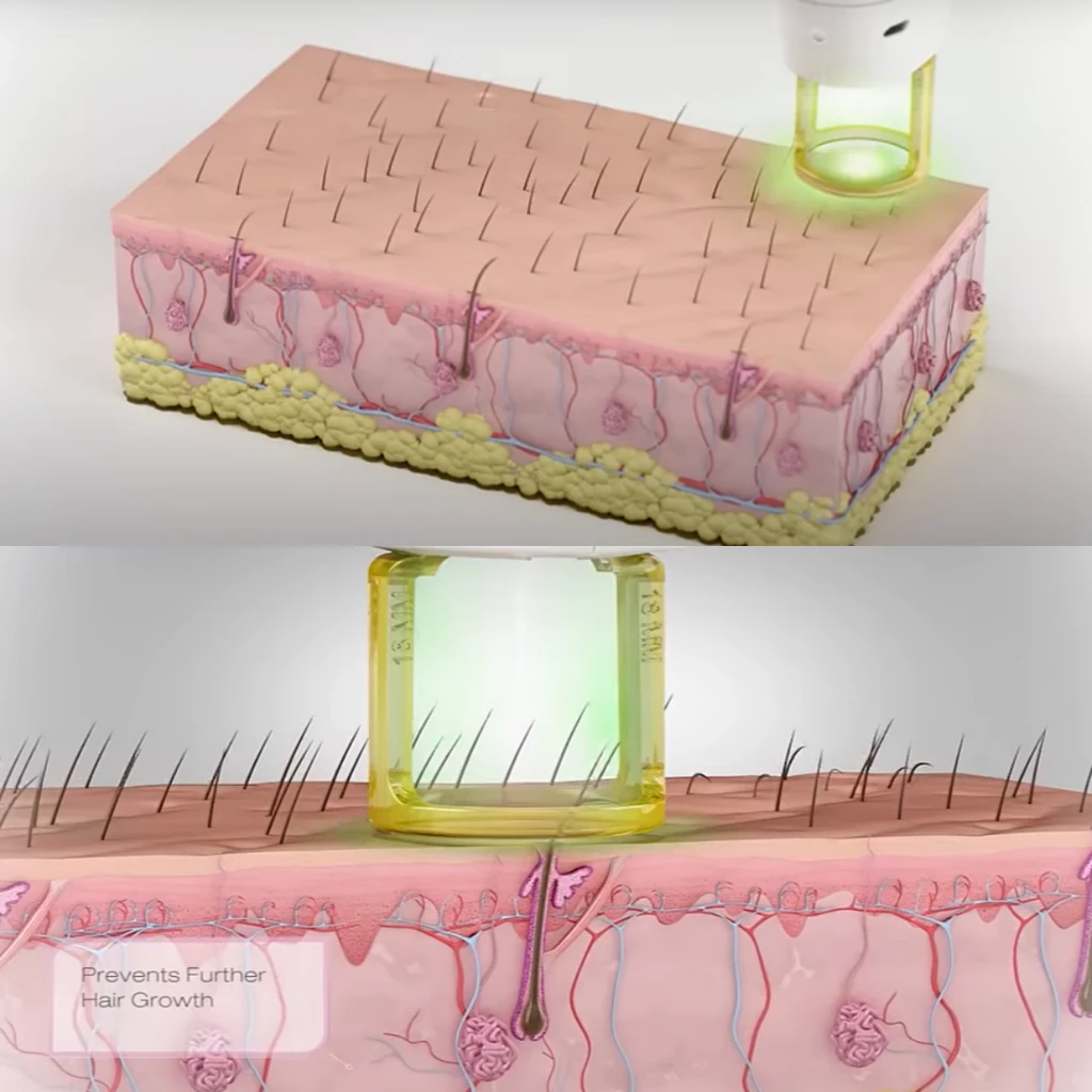 treatmentIntroduction