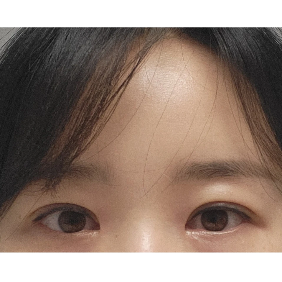 before_image