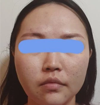 before_image