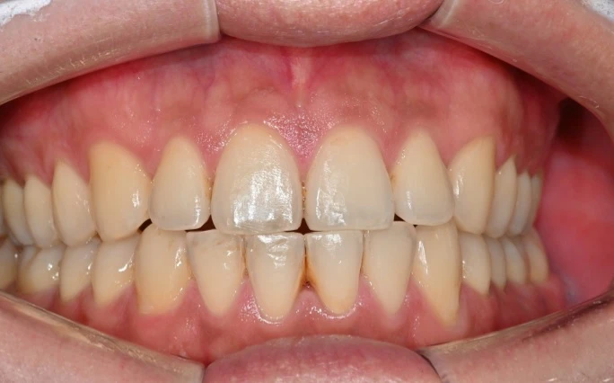before_image