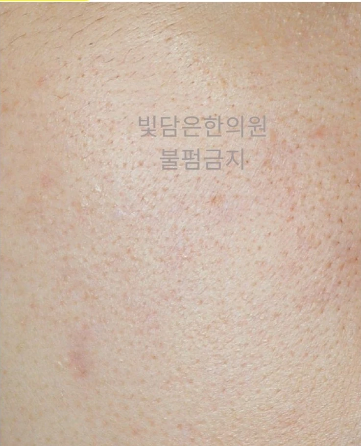 before_image