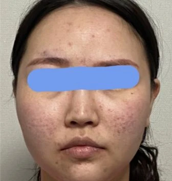 before_image