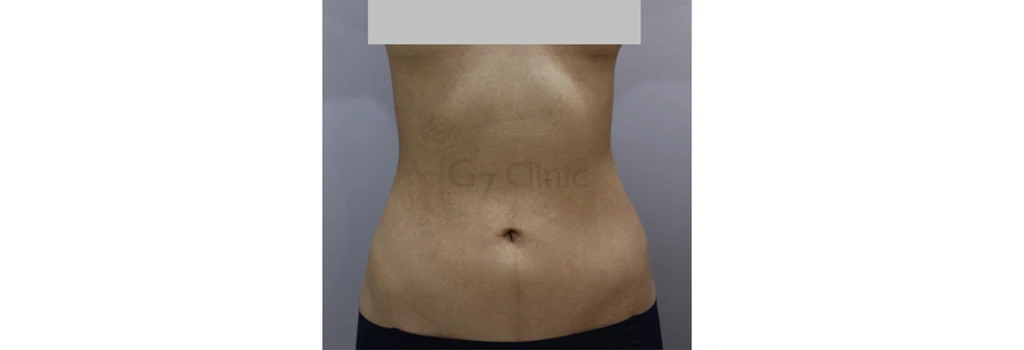 before_image