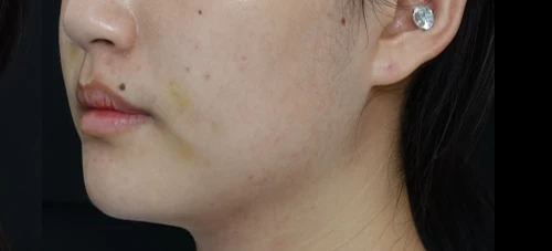 before_image