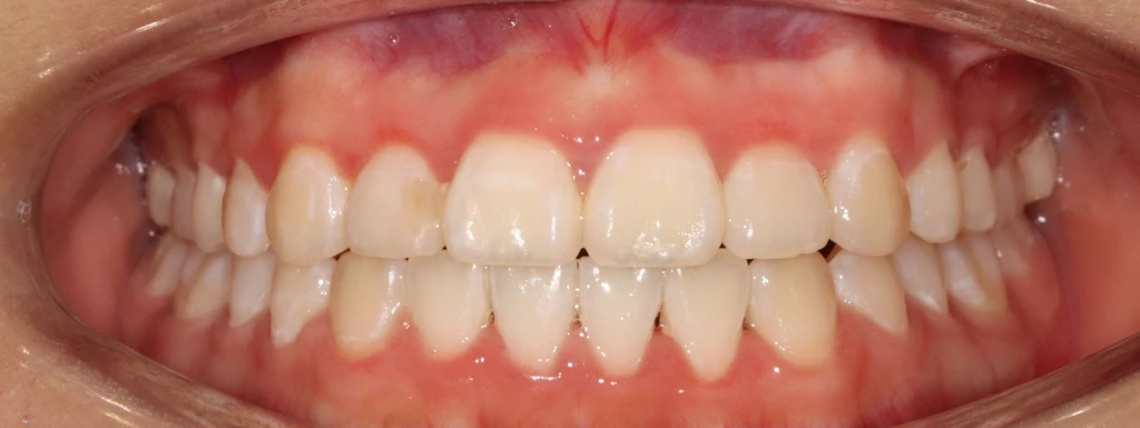 before_image