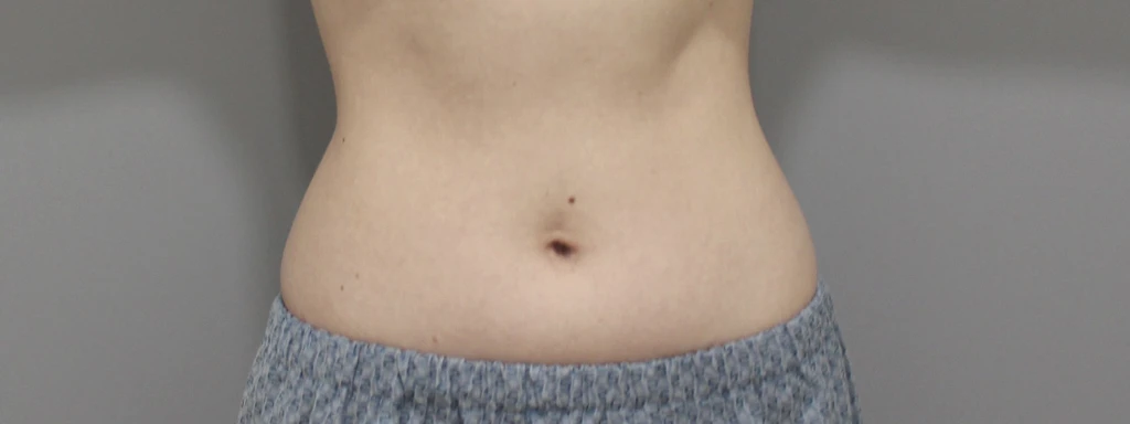 before_image