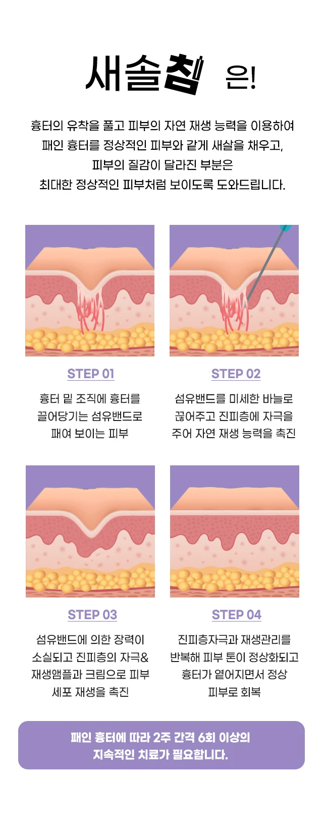 treatmentIntroduction