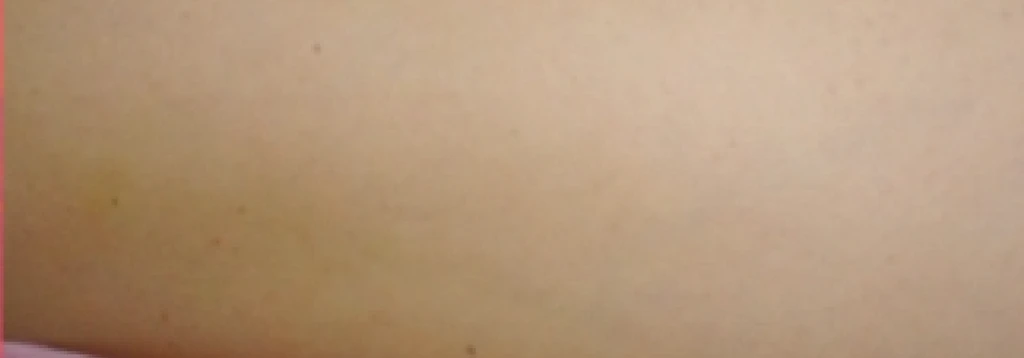 before_image