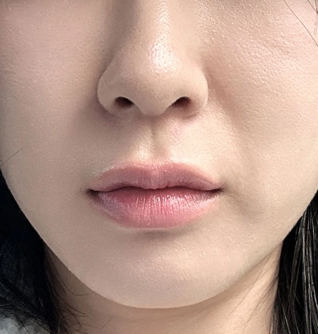 before_image