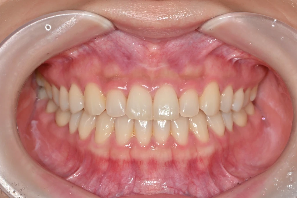 before_image