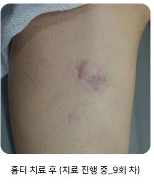 before_image