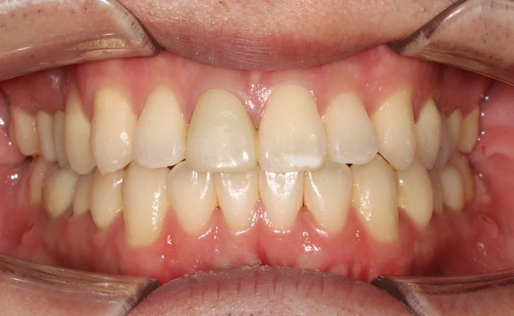 before_image