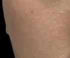 before_image