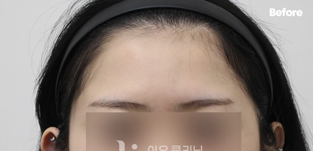 before_image