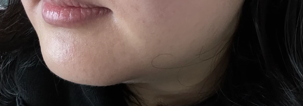 before_image