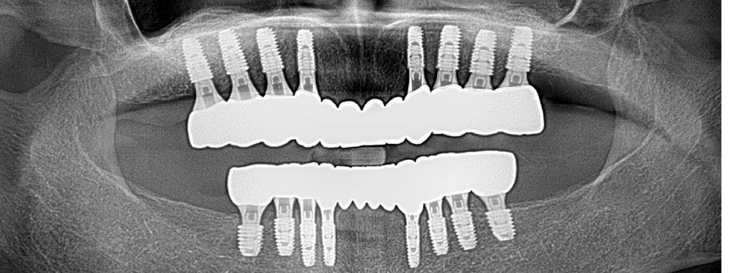 before_image