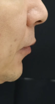 before_image