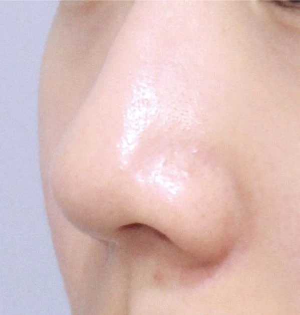 before_image