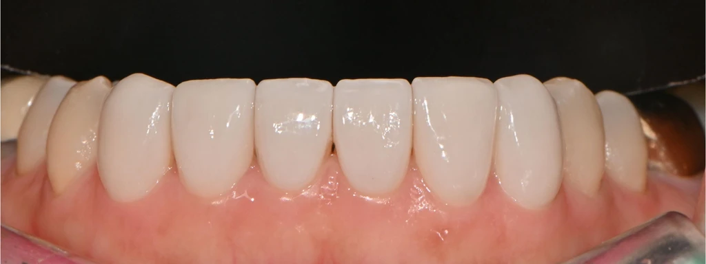 before_image