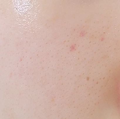 before_image
