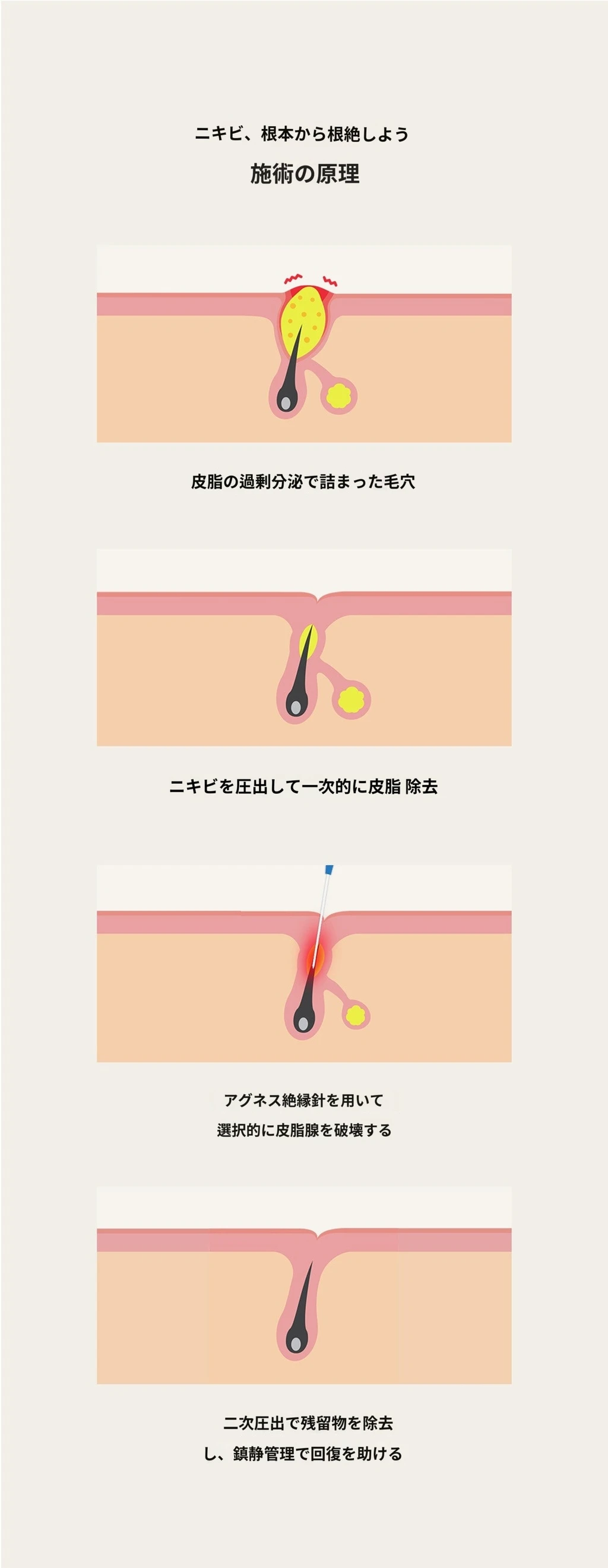 treatmentIntroduction