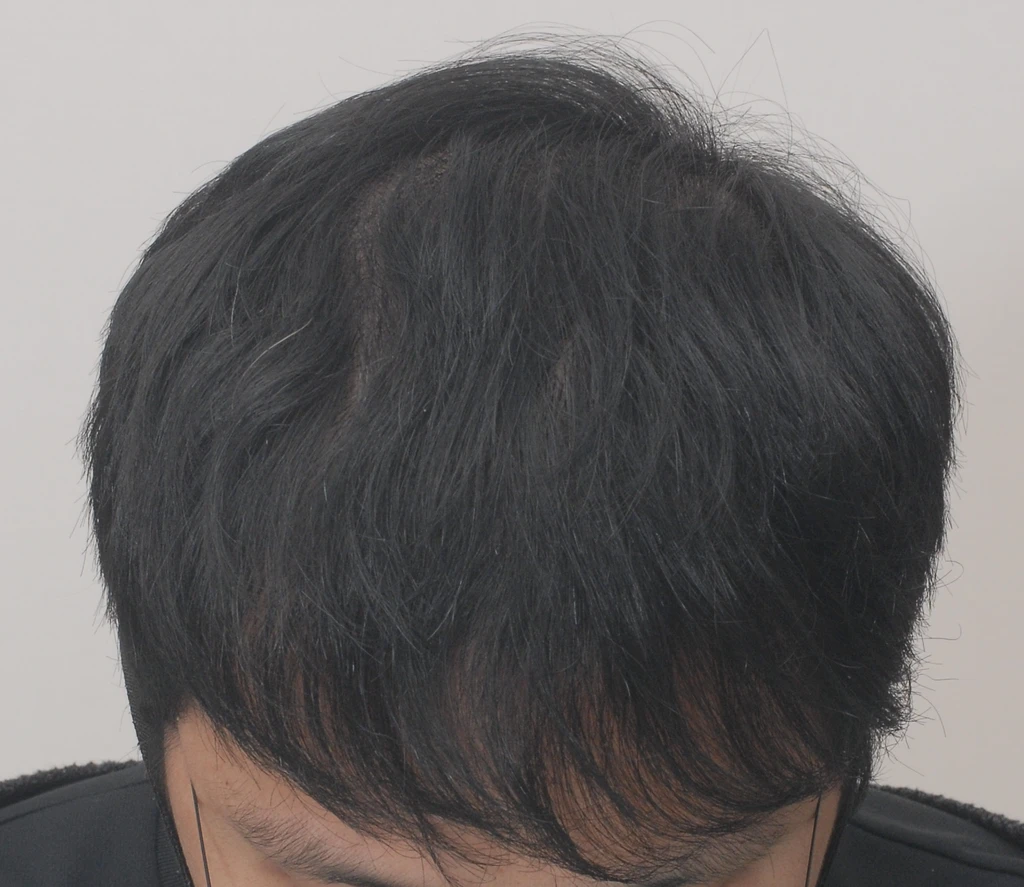 before_image